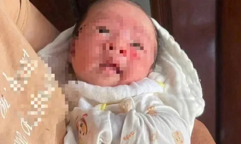 Xót xa mảnh giấy ghi tên "Nấm" cùng 15 triệu đồng tiền mặt trong giỏ đồ cạnh bé gái sơ sinh bị bỏ rơi ở trạm điện