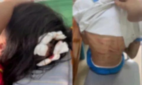 Vụ bé gái lớp 5 nghi bị cha dượng bạo hành: Hiệu trưởng tiết lộ về sức khỏe của nạn nhân