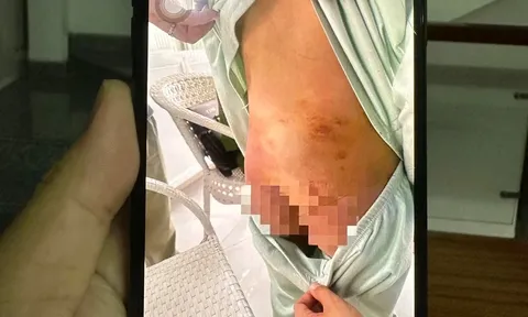 Mẹ ruột 25 tuổi cùng bạn trai 19 tuổi bạo hành bé gái 9 tuổi: Lời khai gây phẫn nộ