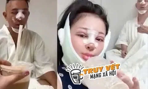 Bác sĩ Chiêm Quốc Thái nói gì về chiếc mũi biến dạng của Ngân 98?