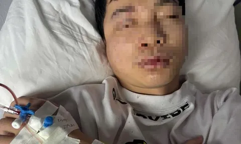 Nam DJ trẻ bị hành hung ở Huế phải nhập viện điều trị: Công an đang trích xuất camera