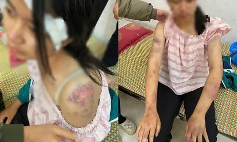 Khởi tố bà nội và 2 ông bạo hành bé gái 13 tuổi ở Thái Nguyên
