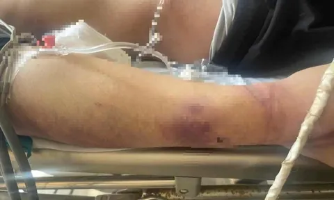 Thông tin mới đáng chú ý vụ học viên Trung tâm công tác xã hội Hải Hà bị đánh chết