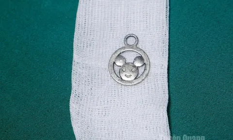 Hoảng hồn: Cứu bé trai 5 tuổi vô tình nuốt móc cặp sách vào bụng