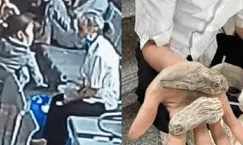 Camera phơi bày màn lừa đảo khó tin ngay tại bệnh viện lớn, bệnh nhân mất toi 4 triệu đồng chỉ vì 2 củ lạ
