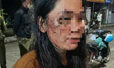 Nữ shipper tố bị khách hàng hành hung vì không cho trả hàng: Hé lộ về cuộc "đôi co" thổi bùng giận dữ