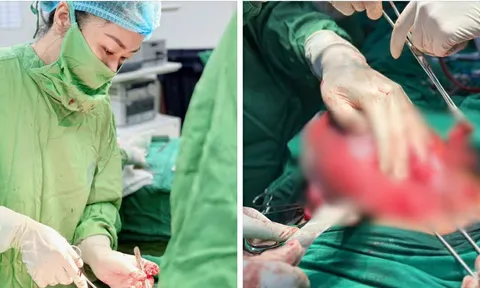 Tưởng đau bụng thông thường, mẹ bầu 34 tuần suýt tử vong vì ruột thừa vỡ, sinh tử trong gang tấc