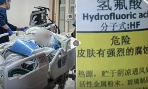 Đi dạo giẫm phải “nước lạ”, 5 ngày sau người phụ nữ tử vong, đó là nước gì?