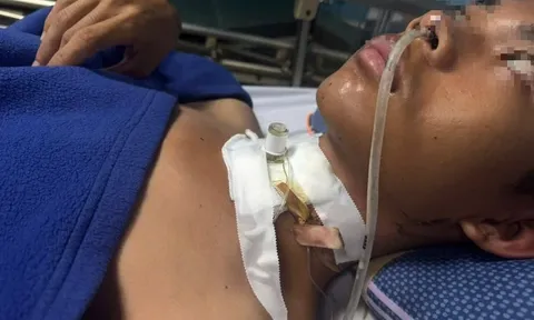 Dây điện sà xuống đường như lưỡi dao, cứa đứt khí quản thiếu niên 15 tuổi, may mắn nạn nhân được cứu sống thần kỳ