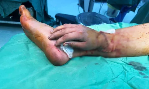 Bàn tay đứt lìa của thai phụ bị tai nạn được ghép tạm vào chân chờ ngày nối lại: Kỳ tích của "từ mẫu" hiện thực hóa ước mơ "được chăm sóc con bằng đôi tay của mình"