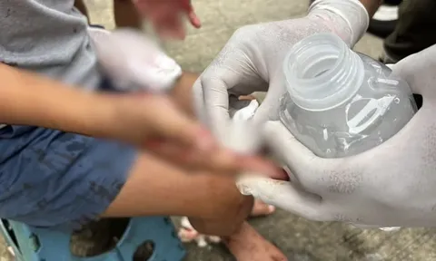 Chỉ vì lý do nhỏ này, bố đẻ nhẫn tâm dùng cưa tấn công con gái, khiến cô bé suýt mất bàn tay phải