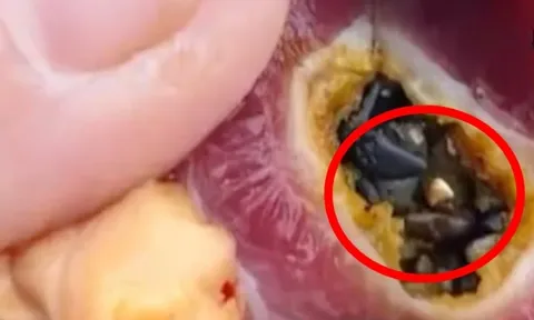 Mổ bụng vịt, sững sờ phát hiện vàng trong dạ dày