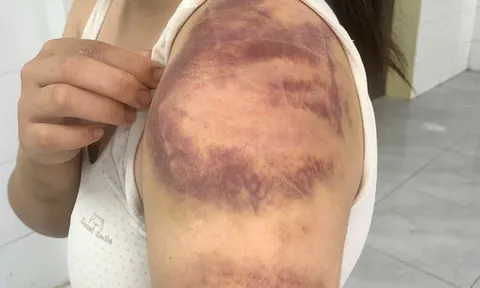 4 lần hành hạ vợ mang thai và con gái trong 4 ngày, Phan Văn Minh bị bắt tạm giam