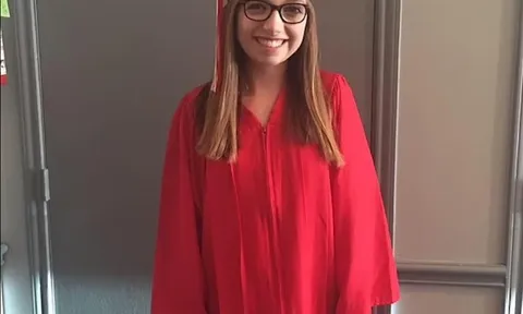 Cô gái bị chó cắn hủy hoại khuôn mặt lột xác sau 28 ca phẫu thuật