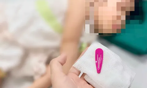 Bé gái 21 tháng tuổi nguy kịch vì thứ vô cùng quen thuộc mà nhà nào có con gái đều không thể thiếu
