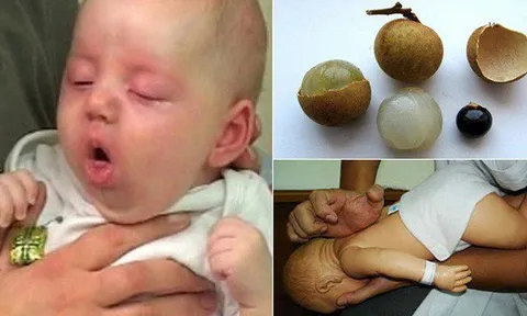 Bé gái 2 tuổi tử vong vì hóc hạt nhãn, lời cảnh tỉnh cho cha mẹ có con nhỏ