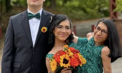 Cặp song sinh dính liền lấy chồng: Hé lộ bí mật khiến cả thế giới tò mò