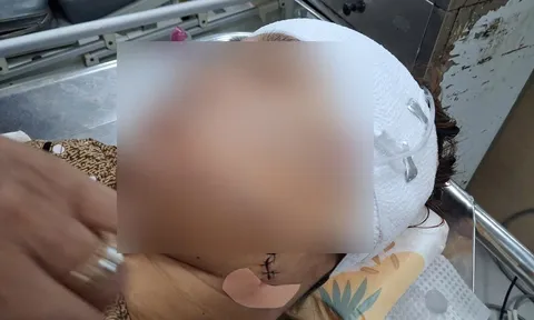 Vụ nghi cán bộ xã rạch mặt tình địch ở Đồng Tháp: Hé lộ lời thách thức khiến vợ nổi cơn ghen