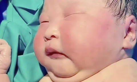 Bé sơ sinh chào đời nặng 9kg, cổ mất hút, bác sĩ đỡ đẻ lắc đầu: “Đứa bé này như trẻ 1 tuổi”