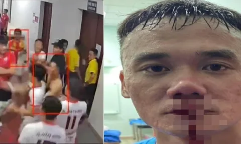 Video: Tiền đạo Xuân Nam bị đấm chảy máu mũi, trung vệ Vũ Văn Sơn nói mình chỉ tự vệ