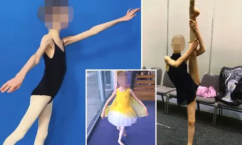 Bị bỏ đói đến mức suy dinh dưỡng nghiêm trọng, cô bé tuổi teen vẫn cố gắng làm điều này cho cha mẹ