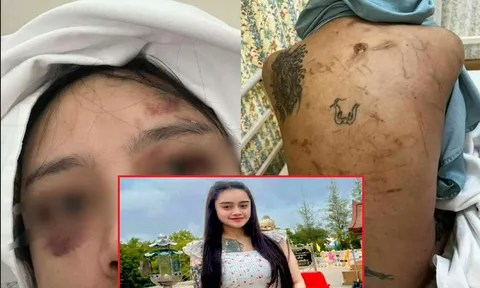 Cô gái bị bạo hành sau khi bỏ nhà đi gặp bạn trai, cha mẹ xót xa khi thấy điều này