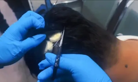 Clip: Cảnh sát "cạy" tóc người đàn ông lên, bất ngờ phát hiện hơn 10.000 USD ma túy