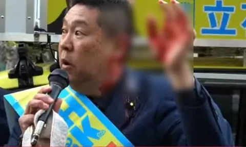 Bắt tay người dân, chính trị gia Nhật Bản bị tấn công bất ngờ