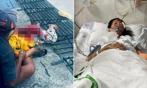 Thái Lan: Người phụ nữ mất tay sau khi vướng áo vào bánh xe