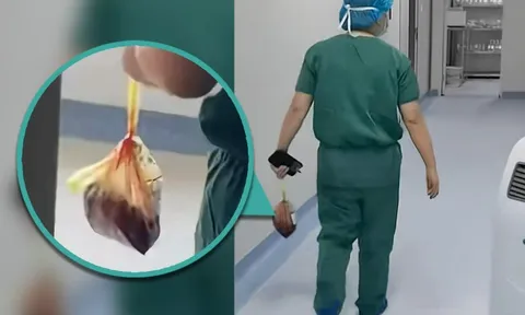 Bác sĩ Trung Quốc mất việc vì lén trộm nhau thai: Bí mật kinh hoàng đằng sau phòng mổ