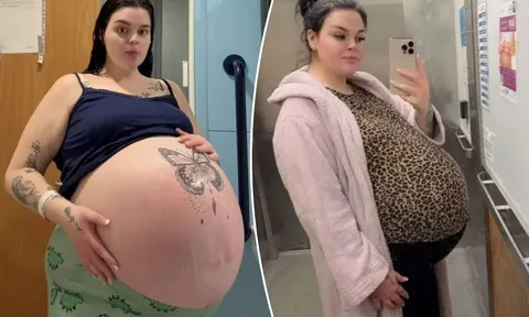 Bụng bầu to bất thường "như 1 căn penthouse”, mẹ trẻ suýt mất con vì biến chứng khó lường
