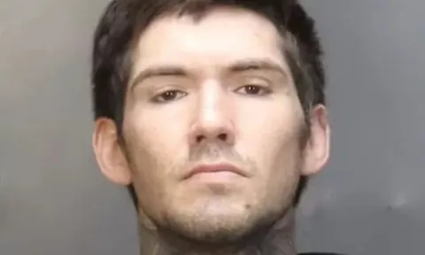 Nói nhiều, người phụ nữ bị bạn trai hắt nước sôi vào người