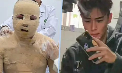 Nam sinh bỏng 90%, bị bạn cùng phòng khóa cửa, bỏ mặc trong biển lửa