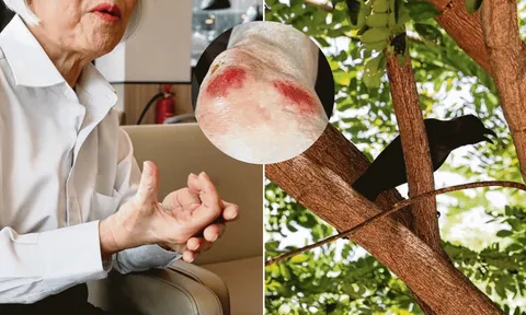 Người phụ nữ 67 tuổi bị quạ mổ vào đầu, ngã gãy tay, sống trong sợ hãi mỗi lần ra đường