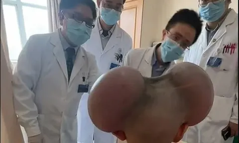 Bé trai bị trêu là ‘Mickey Mouse’ vì khối u ở đầu, hồi phục thần kỳ sau ca phẫu thuật dài 6 tiếng
