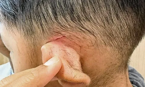 Bé 3 tuổi khóc thét vì bị thợ cắt vào tai, salon thờ ơ, bố mẹ giận dữ đòi kiện