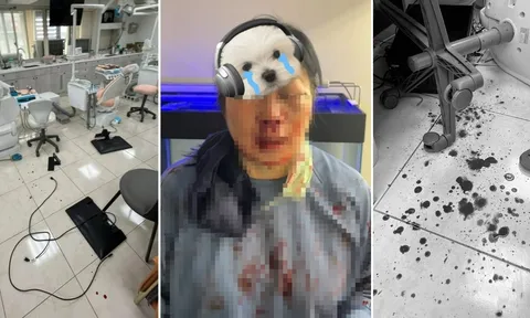 Chỉ vì “lấy cao răng quá đau”, nữ nha sĩ bị bệnh nhân đánh trọng thương, suýt mù mắt