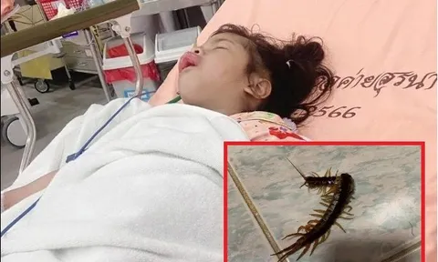 Bị rết cắn vào miệng khi ngủ, bé gái 3 tuổi phải nhập viện khẩn cấp