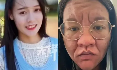 Mặt biến dạng, tóc rụng, da nám: Người mẹ trẻ kể chuyện vượt cạn khiến ai cũng cảm phục