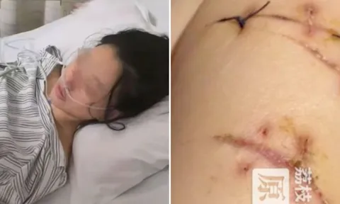 Thoát chết kỳ diệu nhờ... ngực giả