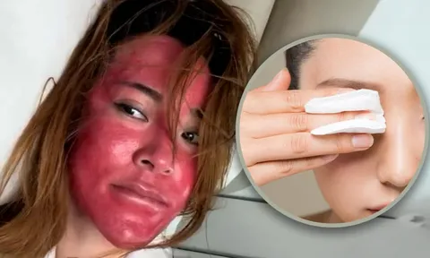 Không tẩy trang suốt 22 năm, người phụ nữ nhận hậu quả đau đớn