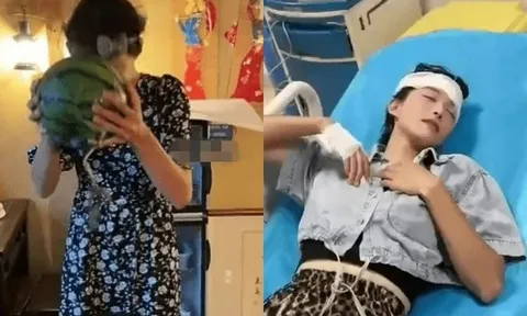 “Thiết đầu công” đời thực: Cô gái nhập viện vì chấn động não sau màn bổ dưa hấu bằng đầu