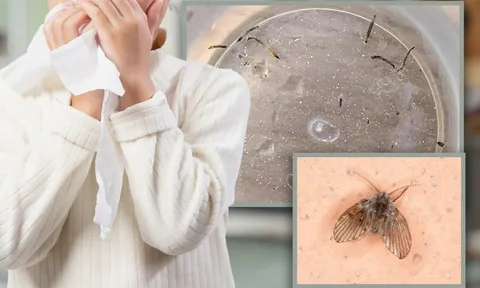 Bé gái 8 tuổi nôn ra giòi sống suốt cả tháng, nguyên nhân khiến ai cũng rùng mình