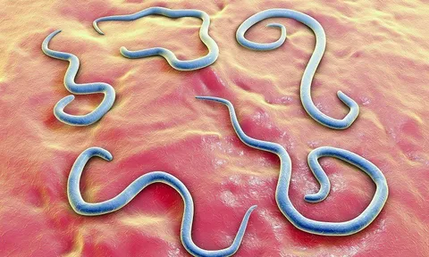 Rùng mình phát hiện giun đũa chó mèo ẩn trong mắt cụ bà suốt 20 ngày