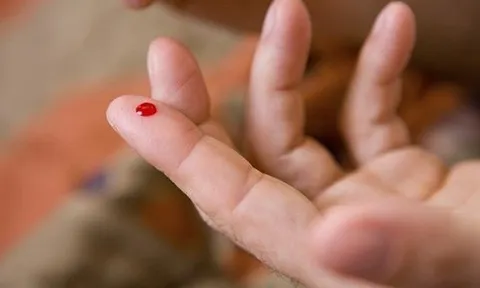 Tin lời mạng xã hội “chích máu đầu ngón tay cứu đột quỵ”, nhiều người vô tình đẩy bệnh nhân vào nguy kịch, bác sĩ cảnh báo sai lầm chết người này