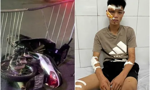 Trao tặng bằng khen ghi nhận tinh thần “vì nước quên thân, vì dân phục vụ” cho đại úy bị thương khi ngăn quái xế 'thông chốt' bảo vệ hợp luyện A80