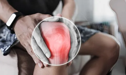 Các nhà khoa học Nga cảnh báo nguy cơ hoại tử xương ở bệnh nhân hậu COVID-19