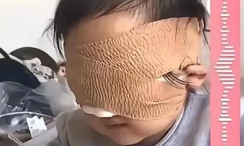 Cả nhà chết lặng khi bé gái 6 tuổi bị mù cả hai mắt chỉ vì thói quen này, nhiều đứa trẻ khác cũng đang mắc phải