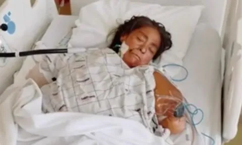 Người phụ nữ bị chó pitbull cắn dữ dội, buộc phải cắt bỏ cả hai tay lẫn hai chân