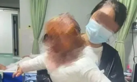 Chỉ vì chiếc bình đun nước trong bếp, bé trai 1 tuổi phải nhập viện vì bỏng 40% cơ thể khiến cha mẹ hoảng loạn